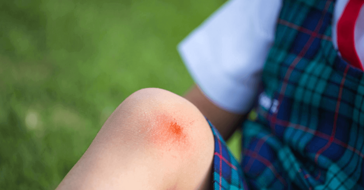 Kids falling - pithal safety tips – 1